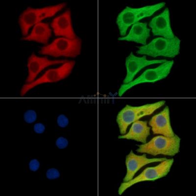 COX18 Antibody - DF15974 staining Hela cells by IF/ICC.