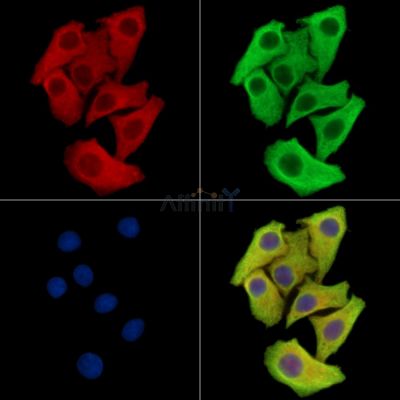VPREB3 Antibody - DF15982 staining Hela cells by IF/ICC.