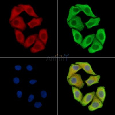 NHLRC2 Antibody - DF15989 staining Hela cells by IF/ICC.