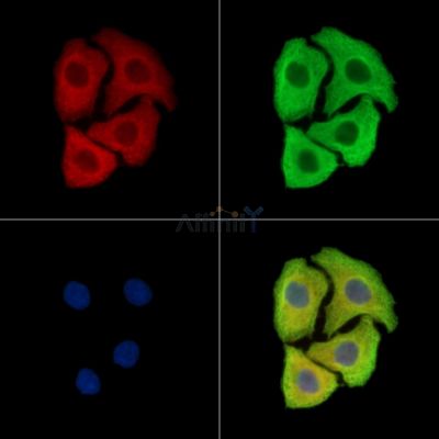 FAM161B Antibody - DF15997 staining Hela cells by IF/ICC.