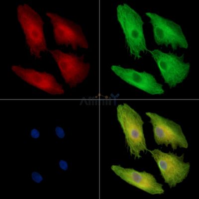 DSC1 Antibody - DF16026 staining A549 cells by IF/ICC.