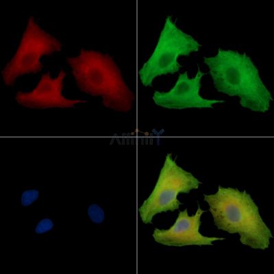 PTAR1 Antibody - DF16027 staining A549 cells by IF/ICC.