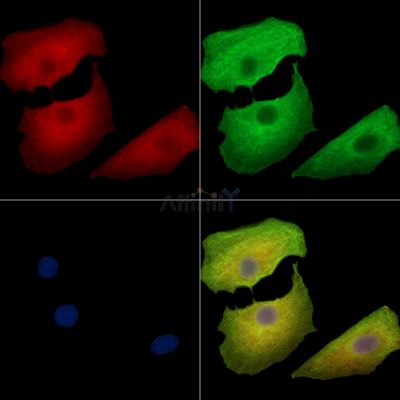 MINDY1 Antibody - DF16046 staining A549 cells by IF/ICC.