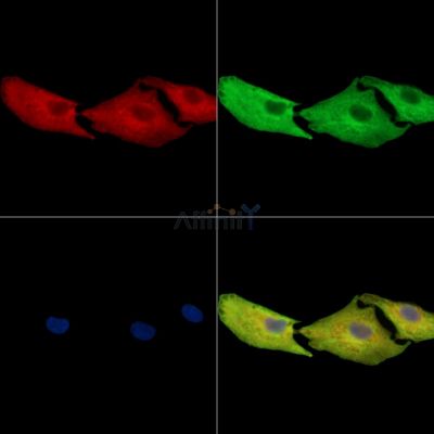 TPCN1 Antibody - DF16053 staining A549 cells by IF/ICC.