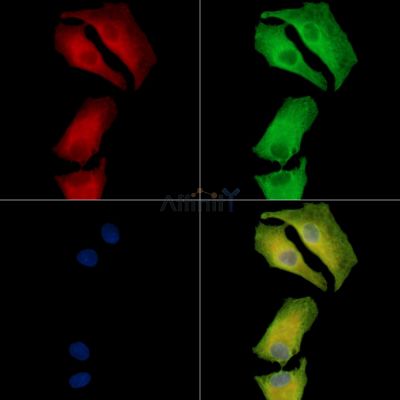 GPATCH2L Antibody - DF16064 staining A549 cells by IF/ICC.