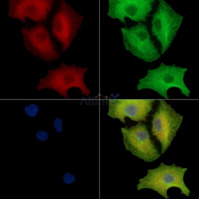 CRELD2 Antibody - DF16071 staining A549 cells by IF/ICC.