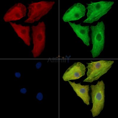LRRCC1 Antibody - DF16075 staining A549 cells by IF/ICC.