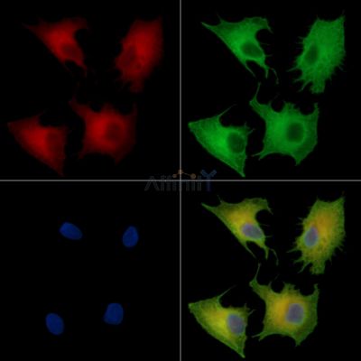 ASB4 Antibody - DF16107 staining A549 cells by IF/ICC.