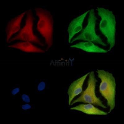 TMEM147 Antibody - DF16117 staining A549 cells by IF/ICC.