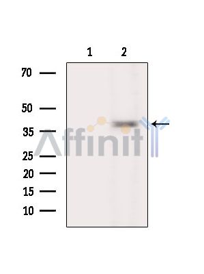 NEUROD6 Antibody - Western blot analysis of extracts from Rat liver, using NEUROD6 Antibody.