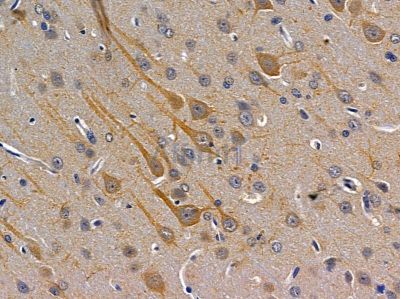 ADCY8 Antibody - DF2271 at 1/100 staining rat brain tissue by IHC-P.
