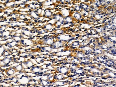 CDH6 Antibody - DF2279 at 1/100 staining mouse kidney tissue by IHC-P.