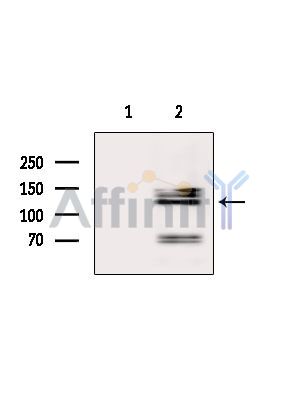 MSH3 Antibody - Western blot analysis of extracts from Hela cells(heat-shock treatment), using MSH3 Antibody.