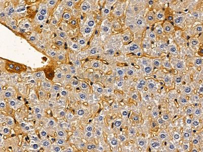 PHLDA3 Antibody - DF2389 at 1/100 staining mouse liver tissue by IHC-P.