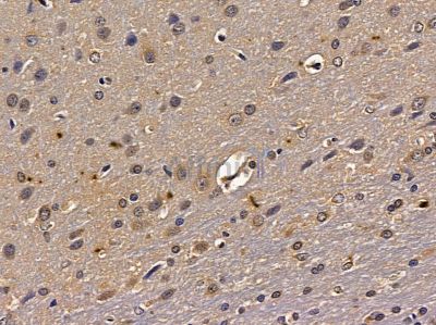 ZSCAN2 Antibody - DF2422 at 1/100 staining rat brain tissue by IHC-P.