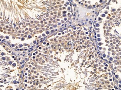 BTBD14B Antibody - DF2450 at 1/100 staining rat testis tissue by IHC-P.