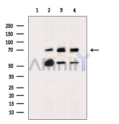 ST2 Antibody - Western blot analysis of extracts from various samples, using ST2 Antibody.