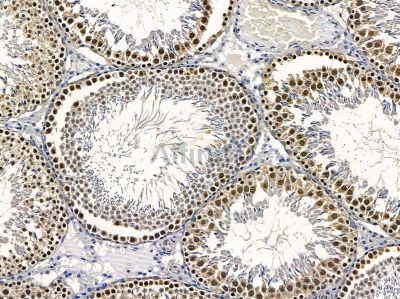 CIRBP Antibody - DF2643 at 1/100 staining rat testis tissue by IHC-P.