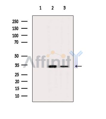 OR2S2 Antibody - Western blot analysis of extracts from various samples, using OR2S2 Antibody.