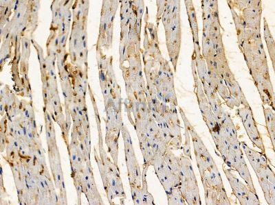 FAM84B Antibody - DF3401 at 1/100 staining mouse heart tissue by IHC-P.