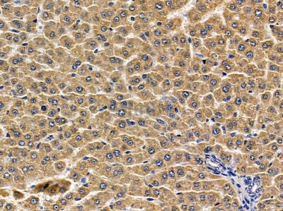 TROVE2 Antibody - DF3693 at 1/100 staining rat liver tissue by IHC-P.
