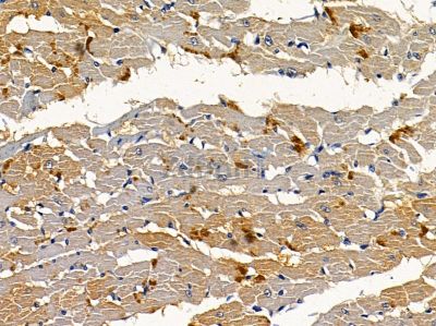 AMPH Antibody - DF3767 at 1/100 staining rat heart tissue by IHC-P.