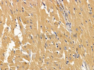 ABCD1 Antibody - DF3813 at 1/100 staining rat heart tissue by IHC-P.