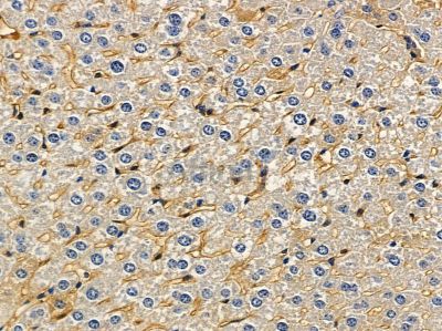 LDLRAD1 Antibody - DF4143 at 1/100 staining mouse liver tissue by IHC-P.