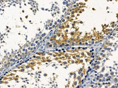 SLC6A15 Antibody - DF4272 at 1/100 staining mouse testis tissue by IHC-P.