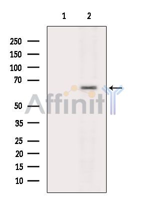 KCNV2 Antibody - Western blot analysis of extracts from HepG2 cells(heat-shock treatment), using KCNV2 Antibody.