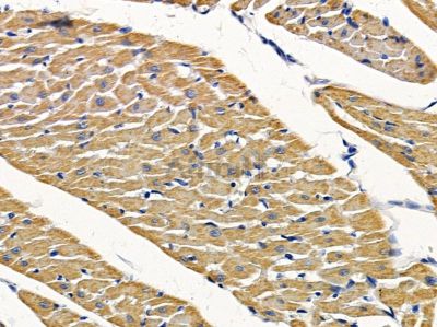 PPP1R14D Antibody - DF4343 at 1/100 staining rat heart tissue by IHC-P.
