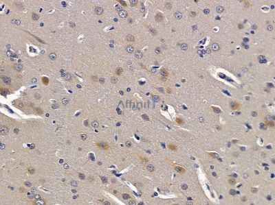 NIM1 Antibody - DF4468 at 1/100 staining rat brain tissue sections by IHC-P.