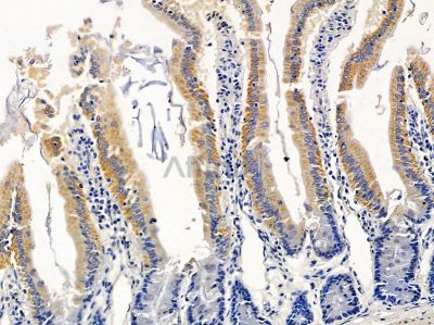 SERPINB12 Antibody - DF4490 at 1/100 staining rat colorectal tissue by IHC-P.