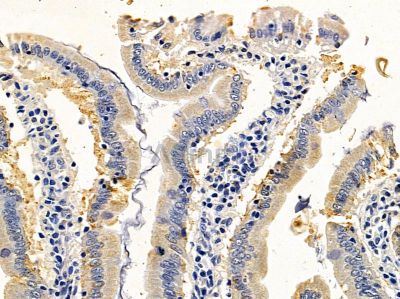 SH2D2A Antibody - DF4497 at 1/100 staining rat colorectal tissue by IHC-P.