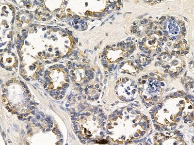 SCN4A Antibody - DF4513 at 1/100 staining colon tissue by IHC-P.