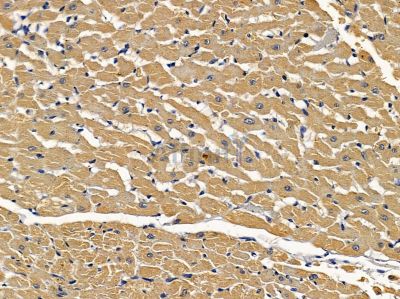 SLC39A9 Antibody - DF4636 at 1/100 staining rat heart tissue by IHC-P.