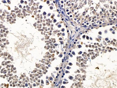 BCL7A Antibody - DF4737 at 1/100 staining rat testis tissue by IHC-P.