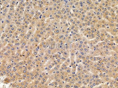 Cytochrome P450 4F11 Antibody - DF4750 at 1/100 staining rat liver tissue by IHC-P.