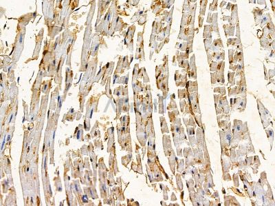 STK10 Antibody - DF4783 at 1/100 staining mouse heart tissue by IHC-P.