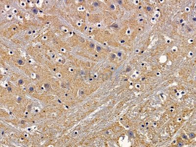 HTR5B Antibody - DF4849 at 1/100 staining mouse brain tissue by IHC-P.