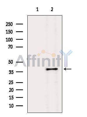 GPR17 Antibody - Western blot analysis of extracts from HepG2 cells(heat-shock treatment), using GPR17 Antibody.