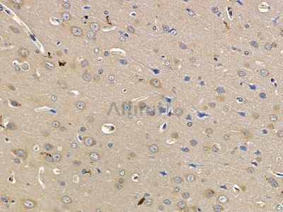 OR4D6 Antibody - DF5092 at 1/100 staining rat brain tissue by IHC-P.