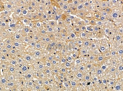 GPRC5A Antibody - DF5148 at 1/100 staining mouse liver tissue by IHC-P.
