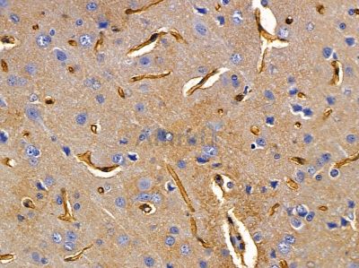 U12 Antibody - DF5216 at 1/100 staining rat brain tissue by IHC-P.