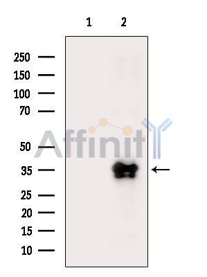 TFPI Antibody - Western blot analysis of extracts from HepG2 cells(heat-shock treatment), using TFPI Antibody.