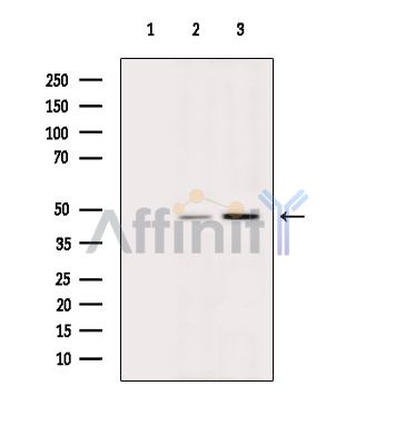PSMC4 Antibody - Western blot analysis of extracts from various samples, using PSMC4 Antibody.