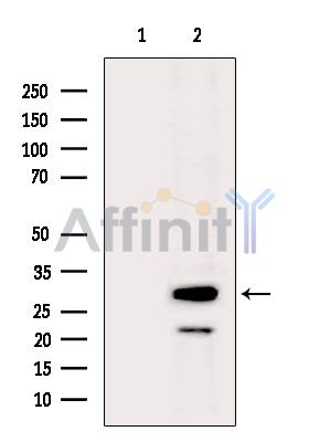 IGFBP1 Antibody - Western blot analysis of extracts from Hela cells(heat-shock treatment), using IGFBP1 Antibody.