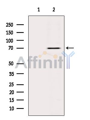 LBR Antibody - Western blot analysis of extracts from Hela cells(heat-shock treatment), using LBR Antibody.