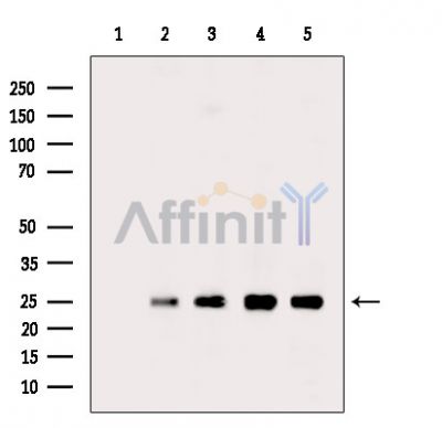 PSMB2 Antibody - Western blot analysis of extracts from various samples, using PSMB2 Antibody.