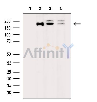Rictor Antibody - Western blot analysis of extracts from various samples, using Rictor Antibody.